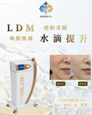 LDM 水滴提升